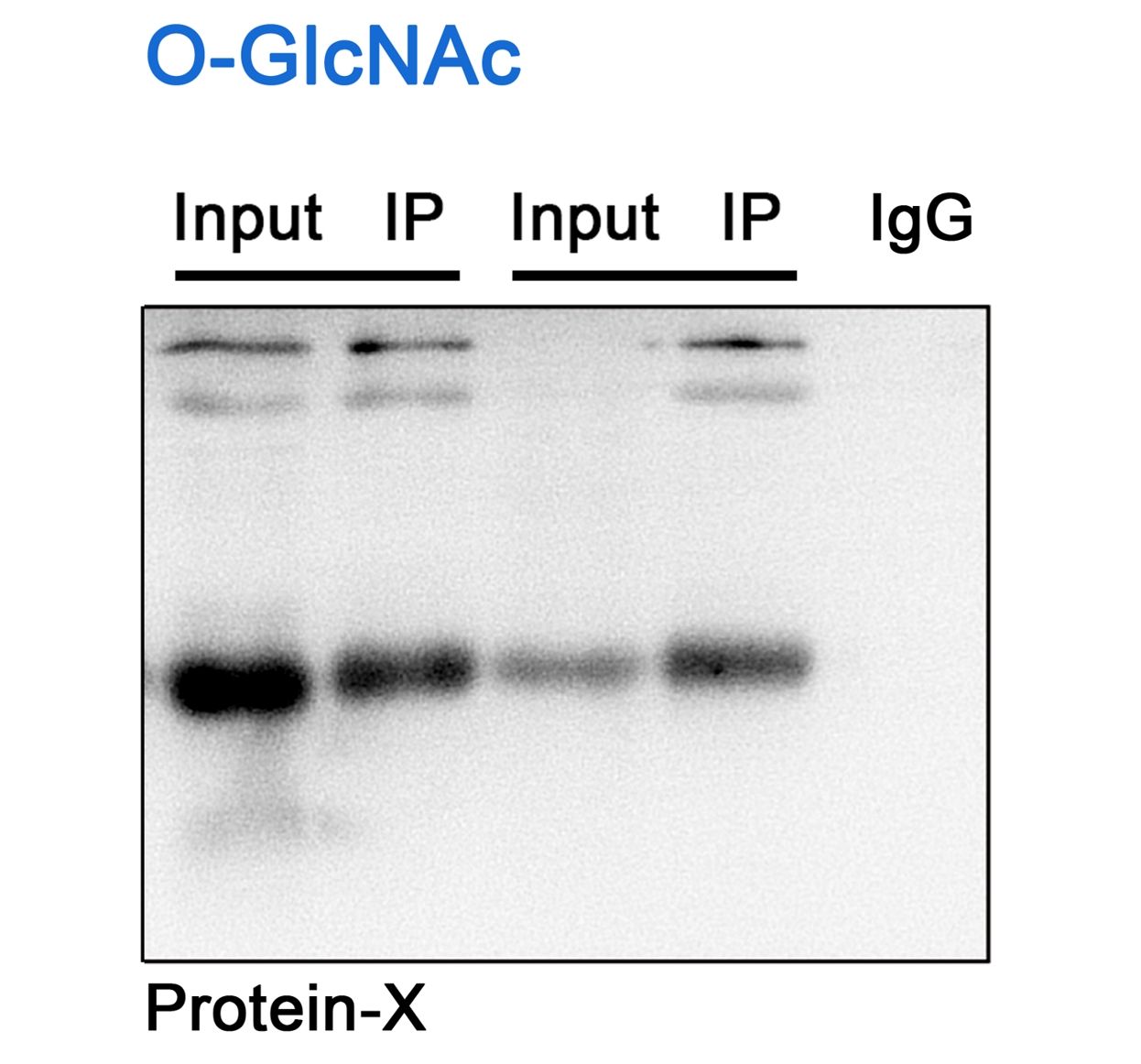 蛋白質糖基化（O-GlcNAc）